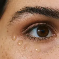 Nahaufnahme eines Auges mit Sommersprossen und Tropfen eines Serums, die die Haut darunter erfrischen. Selbst leichte **Schatten unter den Augen** können so verschwinden.