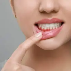 Skuteczne sposoby na opuchnięte dziąsła i kiedy udać się do dentysty