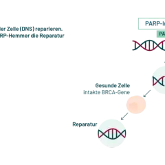 PARP-Inhibitoren blockieren die Reparatur von DNS-Schäden in Krebszellen mit BRCA-Mutation, was zu deren Absterben führt. Erste parp-inhibitor erfahrungsberichte zeigen Erfolge.