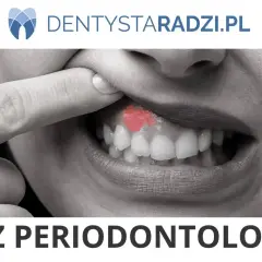 Palec wskazuje na zaczerwienione dziąsło, objaw parodontozy. NFZ periodontologia.