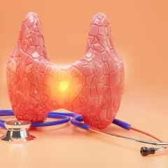 Model tarczycy z widocznym ogniskiem zapalnym, sugerującym raka rdzeniastego tarczycy. Obok leży stetoskop, symbol diagnostyki medycznej.
