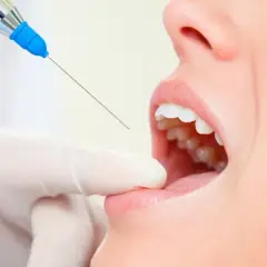 Znieczulenie u dentysty: Koniec z bólem? Sprawdź nowoczesne metody!