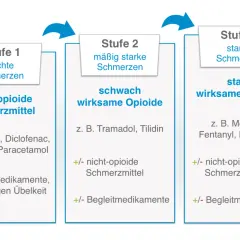 Übersicht über welche Arten von Chemotherapie es gibt: Stufe 1 (leichte Schmerzen) mit nicht-opioiden Mitteln, Stufe 2 (mäßig starke Schmerzen) mit schwach wirksamen Opioiden und Stufe 3 (starke Schmerzen) mit stark wirksamen Opioiden.
