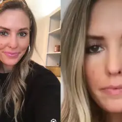 Kobieta z blond włosami i opaską na głowie, po lewej uśmiechnięta, po prawej z zaskoczonym wyrazem twarzy, sugerującym efekt botoks brwi.