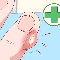 Gros plan d'un doigt enflammé avec une corne sur les mains, entouré d'un symbole médical vert.