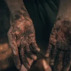 Brudne dłonie, jak po próbie molestowania, symbolizują walkę i potrzebę oczyszczenia.