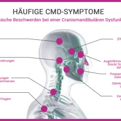 Kopfschmerzen Stirn, Migräne, Druckgefühl am Kopf und Gesichtsschmerzen sind häufige CMD-Symptome.