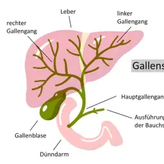 Schema des Gallensystems: Leber, Gallenblase, Gallengänge. Ein gallengang verstopft kann die lebenserwartung beeinflussen.