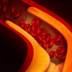 Cholesterol 200 czy to dużo? Sprawdź, co to oznacza dla zdrowia