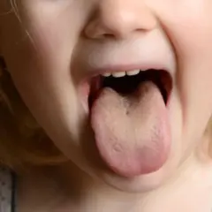 Dziecko pokazuje język z delikatnym, żółtym nalotem.