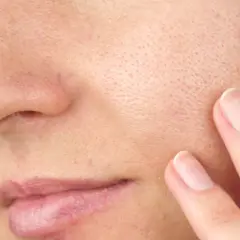 Gros plan sur une peau avec des pores visibles. Une main effleure la joue, suggérant une recherche de solutions pour comment enlever l'excès de sebum visage naturellement.