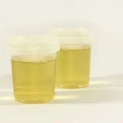 Dwa pojemniki z żółtym płynem, potencjalnie badanie na obecność ketony w moczu.