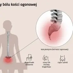 Ból kości ogonowej (kokcygodynia) może być spowodowany długotrwałym siedzeniem, urazami kręgosłupa, ciążą i porodem lub chorobami proktologicznymi.