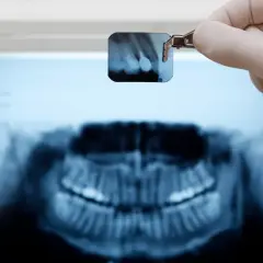 Rtg zęba jak odczytać? Dentysta trzyma małe zdjęcie RTG, analizując je na tle większego obrazu szczęki.