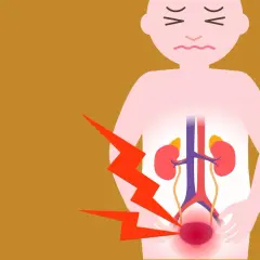 Douleur intense au bas du dos et à la vessie, suggérant une sciatique et une vessie hyperactive. L'image montre un schéma du système urinaire avec des éclairs rouges.