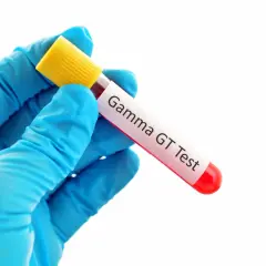 Rękawiczka z niebieskiej lateksu trzyma probówkę z krwią do badania Gamma GT. To badanie ocenia funkcję wątroby.