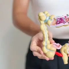 Model jelita grubego z widocznymi zmianami, które mogą być związane z ibs objawy.