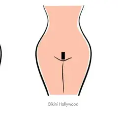 Depilacja laserowa bikini: Ile trwa? Pełny harmonogram i efekty