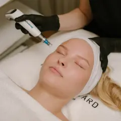 En kvinna får en behandling med Dermapen. Även om hon är gravid, kan hon njuta av hudvård.