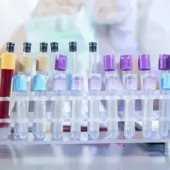 Jak uzupełnić niedobór sodu? Bezpieczne sposoby i sygnały alarmowe