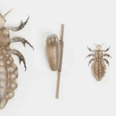 Un pidocchio adulto, una lendine e un piccolo pidocchio indicato da una freccia rossa su un righello. Quanto vive un pidocchio sul cuscino?