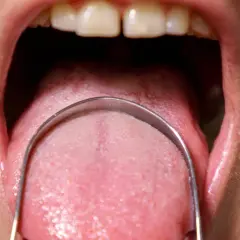 Lingua rosa con strumento metallico, evidenziando le papille gustative pronte a percepire sapori.
