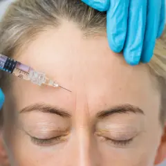 Zabieg baby botox na czole. Ręka w niebieskiej rękawiczce trzyma strzykawkę z igłą, która wstrzykuje preparat w zmarszczki mimiczne.