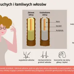 Ilustracja porównująca zdrowe i uszkodzone włosy, z ikonami objawów.