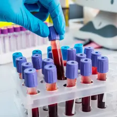 Ręka w niebieskiej rękawiczce pobiera probówkę z krwią. W tle stojaki z próbkami, sprzęt laboratoryjny. To ważny etap w badaniach arhd+.