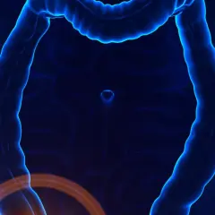 Anatomical illustration showing the intestines with a highlighted area indicating potential zapalenie wyrostka robaczkowego.