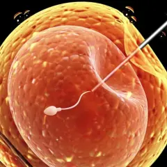 Sperm wstrzykiwany do komórki jajowej, proces wspomagany przez Ovitrelle.