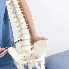 Fizjoterapeuta pokazuje model kręgosłupa, omawiając wpływ torbieli pajęczynówki na wysiłek fizyczny.