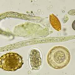 Microscopio muestra varios tipos de lombrices intestinales en perros, incluyendo huevos y larvas de parásitos.