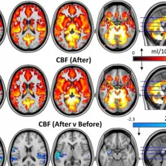 Psylocybina na depresję: Czy "resetuje" mózg? Badania i prawo