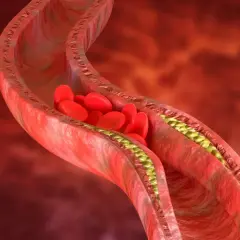 Cholesterol 240 czy to dużo? Sprawdź, jakie niesie zagrożenia