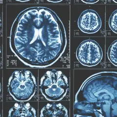 Imágenes de resonancia magnética cerebral. Cortes axiales y sagitales que muestran la estructura del cerebro, como si fuera una memoria fotogénica.