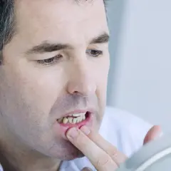Ból dziąseł: Przyczyny, domowe sposoby i kiedy iść do dentysty