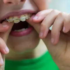 Dziecko z aparatem ortodontycznym typu twin block poprawia jego ułożenie palcami.