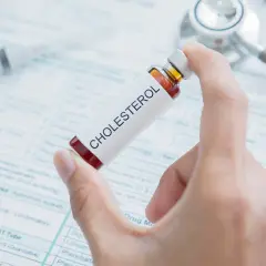 Dłoń trzyma fiolkę z napisem "CHOLESTEROL" na tle dokumentacji medycznej i stetoskopu. Czy tabletki na cholesterol trzeba brać do końca życia?