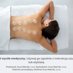 Kobieta z bańkami na plecach, stosowanymi jako metoda wspomagająca leczenie kaszlu.