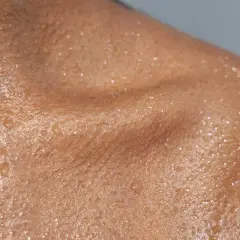 Skóra na szyi z kropelkami potu, może to być reakcja na uczulenie na perfumy.