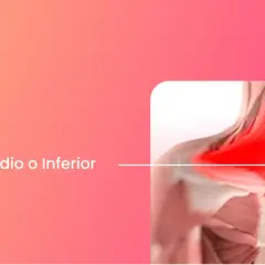 Dolor miofascial en el trapecio medio o inferior, con área inflamada en rojo.