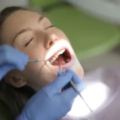 Kobieta z zamkniętymi oczami poddaje się zabiegowi stomatologicznemu. Dentysta w niebieskich rękawiczkach wykonuje kiretaż zamknięty, używając narzędzi do oczyszczania zębów.