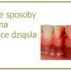 Jaki lek na zapalenie dziąseł? Skuteczne metody i domowe sposoby