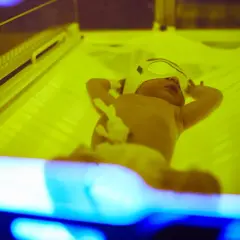 Zespół Gilberta: Podwyższona bilirubina to nie wyrok! Poznaj fakty