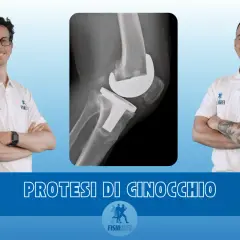 Due medici sorridono accanto a una radiografia di un ginocchio protesico, simbolo di recupero e miglioramento dei movimenti del polso.