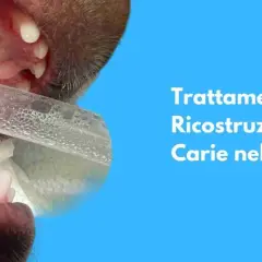 Primo piano di un dente canino di cane con una carie in fase di trattamento.