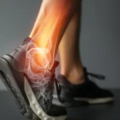 Anatomia skręconej kostki z widocznymi kośćmi i zapaleniem.