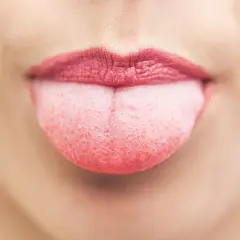 Lingua gonfia, segno di stress. La bocca è aperta, le labbra rosse e la lingua rosa sporge, mostrando la sua superficie ruvida.