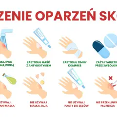Instrukcja leczenia oparzeń skóry: chłodna woda, maść z antybiotykiem, zimny kompres, leki przeciwbólowe, aloes. Unikaj masła, jajka, pasty do zębów, lodu.